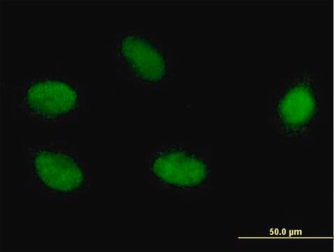 Monoclonal Anti-ELAC2 antibody produced in mouse clone 1A2, purified immunoglobulin, buffered aqueous solution