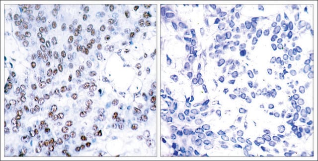 Anti-JUNB (Ab-79) antibody produced in rabbit affinity isolated antibody