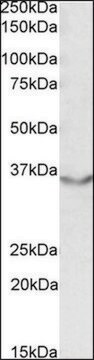 Anti-JAM2 antibody produced in goat affinity isolated antibody, buffered aqueous solution