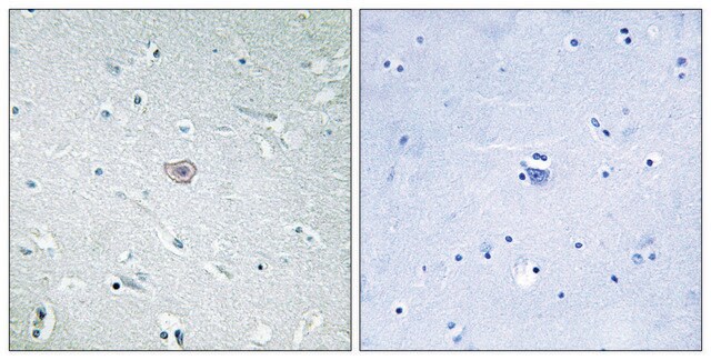 Anti-PE2R3 antibody produced in rabbit affinity isolated antibody