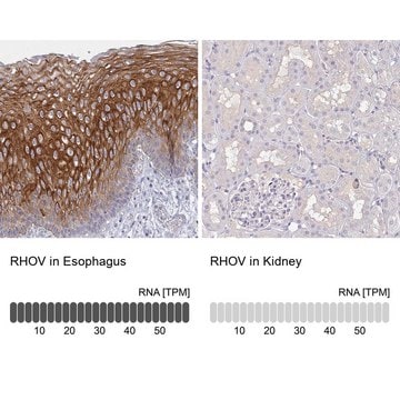 Anti-RHOV antibody produced in rabbit Prestige Antibodies&#174; Powered by Atlas Antibodies, affinity isolated antibody, buffered aqueous glycerol solution