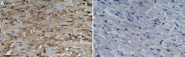 Anti-AHNAK Antibody, clone 1H6 ZooMAb&#174; Rabbit Monoclonal recombinant, expressed in HEK 293 cells