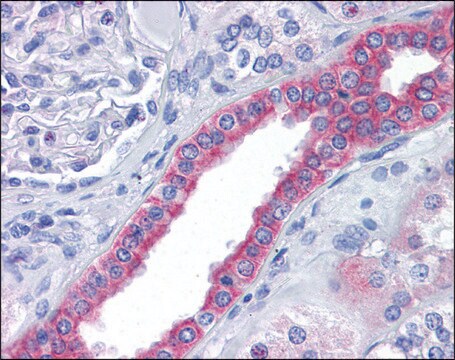 Anti-SKA2 antibody produced in rabbit affinity isolated antibody