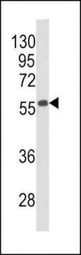 ANTI-BECLIN1-BH3 DOMAIN antibody produced in rabbit affinity isolated antibody, buffered aqueous solution