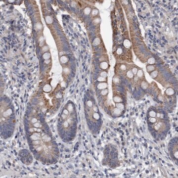 Anti-DDHD2 antibody produced in rabbit Prestige Antibodies&#174; Powered by Atlas Antibodies, affinity isolated antibody, buffered aqueous glycerol solution, Ab1