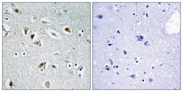 Anti-CDKA2 antibody produced in rabbit affinity isolated antibody