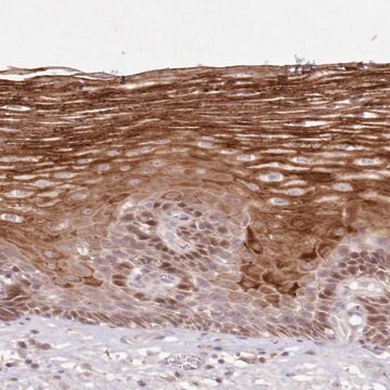 Anti-ASCC1 antibody produced in rabbit Prestige Antibodies&#174; Powered by Atlas Antibodies, affinity isolated antibody, buffered aqueous glycerol solution