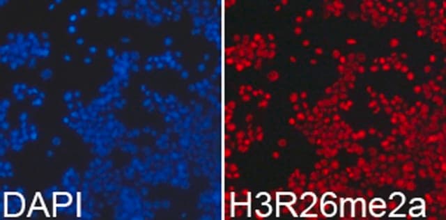 Anti-Asymmetric DiMethyl-Histone H3-R26 antibody produced in rabbit