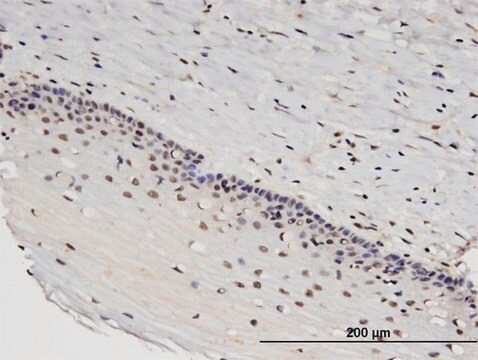 Monoclonal Anti-RTKN2 antibody produced in mouse clone 2C2, purified immunoglobulin, buffered aqueous solution