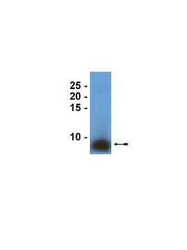 Anti-Surfactantprotein-B-Antikörper serum, Upstate&#174;