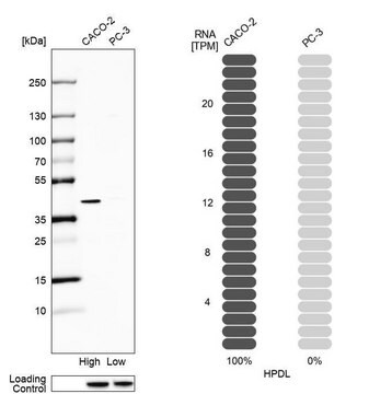 Anti-HPDL antibody produced in rabbit Prestige Antibodies&#174; Powered by Atlas Antibodies, affinity isolated antibody, buffered aqueous glycerol solution