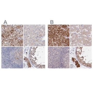 Anti-AAMDC antibody produced in rabbit Prestige Antibodies&#174; Powered by Atlas Antibodies, affinity isolated antibody, buffered aqueous glycerol solution