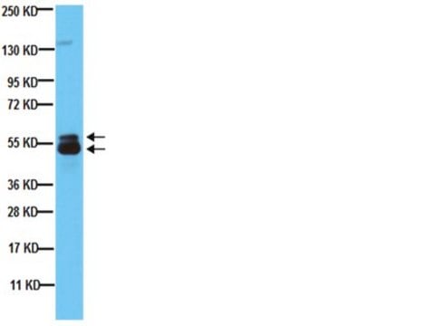 Anti-Microphthalmia (Mi) Antibody, clone C5 clone C5, Chemicon&#174;, from mouse