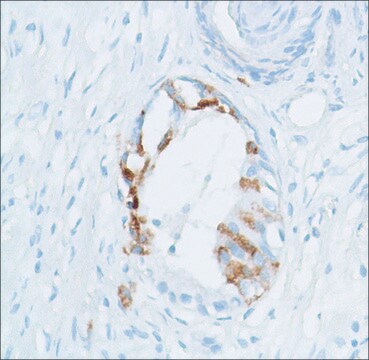 Anti-SPINK1 antibody, Rabbit monoclonal clone SP166, recombinant, expressed in proprietary host, affinity isolated antibody