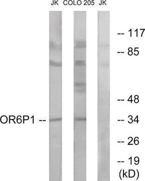 Anti-OR6P1 antibody produced in rabbit affinity isolated antibody