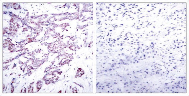 Anti-phospho-STAT6 (pThr645) antibody produced in rabbit affinity isolated antibody