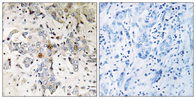 Anti-ZCCHC17 antibody produced in rabbit affinity isolated antibody