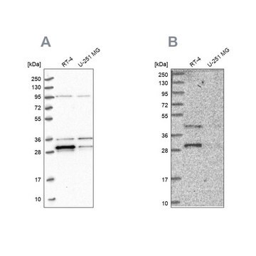 Anti-PPTC7 antibody produced in rabbit Prestige Antibodies&#174; Powered by Atlas Antibodies, affinity isolated antibody, buffered aqueous glycerol solution