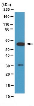 Anticuerpo anti-calcineurina pan-A from rabbit, purified by affinity chromatography