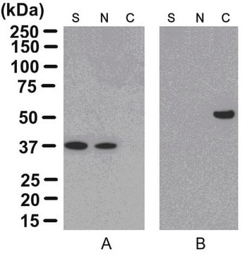 ProteoExtract&#174; Cytoskeleton Enrichment and Isolation Kit This kit provides cytoskeleton purification detergent buffers, sufficient for extraction from ten 100 mm culture dishes, that retain focal adhesion &amp; actin-associated proteins while removing soluble cytoplasmic &amp; nuclear proteins from the cell.