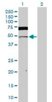 Anti-CSNK2A1 antibody produced in rabbit purified immunoglobulin, buffered aqueous solution