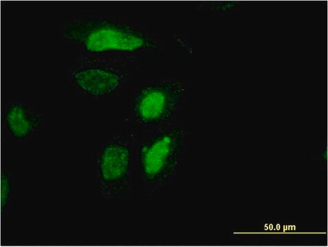 Monoclonal Anti-RDH12 antibody produced in mouse clone 1E11, purified immunoglobulin, buffered aqueous solution