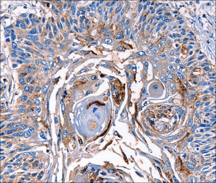 Anti-LRP2 antibody produced in rabbit affinity isolated antibody