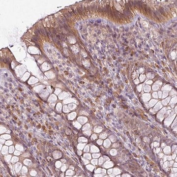 Anti-LY75 antibody produced in rabbit Prestige Antibodies&#174; Powered by Atlas Antibodies, affinity isolated antibody, buffered aqueous glycerol solution