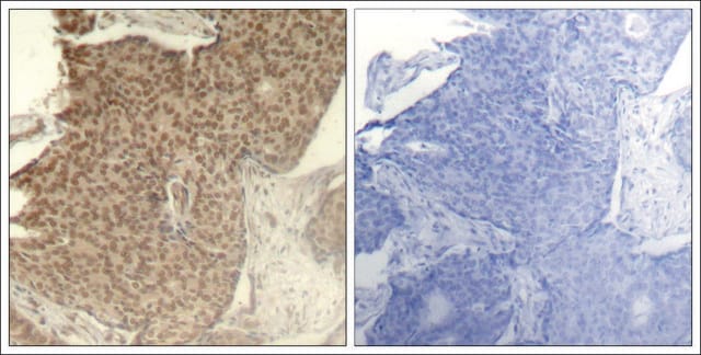 Anti-phospho-HDAC2 (pSer394) antibody produced in rabbit affinity isolated antibody