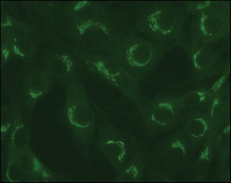 抗 TGN38 兔抗 ~1&#160;mg/mL, affinity isolated antibody, buffered aqueous solution