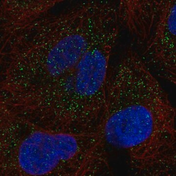 Anti-SLC25A17 antibody produced in rabbit Prestige Antibodies&#174; Powered by Atlas Antibodies, affinity isolated antibody