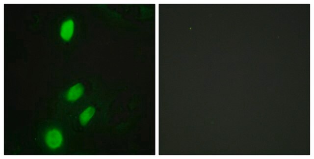 Anti-ETV6 antibody produced in rabbit affinity isolated antibody