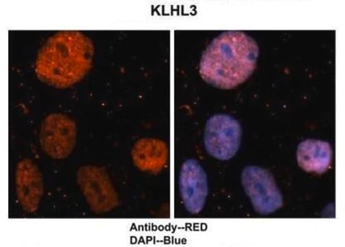 Anti-KLHL3, (N-terminal) antibody produced in rabbit affinity isolated antibody