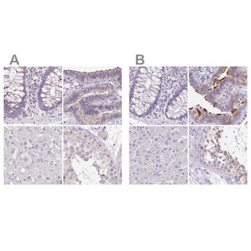 Anti-ANKRD45 antibody produced in rabbit Prestige Antibodies&#174; Powered by Atlas Antibodies, affinity isolated antibody, buffered aqueous glycerol solution, ab1