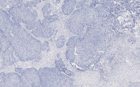 Anti-TAGLN Antibody, clone 1D10 , ZooMAb&#174; Rabbit Monoclonal recombinant, expressed in HEK 293 cells