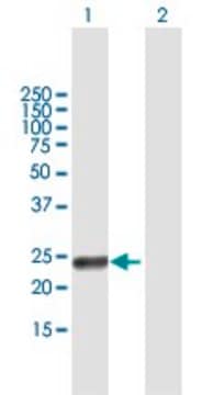 Anti-RAET1G antibody produced in mouse purified immunoglobulin, buffered aqueous solution