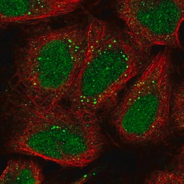 Anti-EXOC6 antibody produced in rabbit Prestige Antibodies&#174; Powered by Atlas Antibodies, affinity isolated antibody