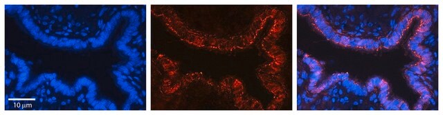 Anti-VDAC2 antibody produced in rabbit affinity isolated antibody