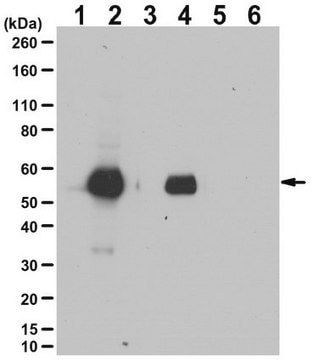 Anti-phospho-Keratin-8 Antibody (Ser23) from rabbit, purified by affinity chromatography