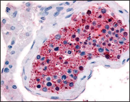 Anti-FZD9 (AB1) antibody produced in rabbit affinity isolated antibody, buffered aqueous solution