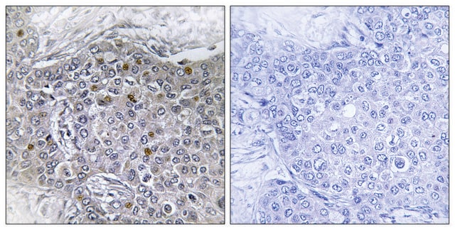 Anti-ZMY11 antibody produced in rabbit affinity isolated antibody