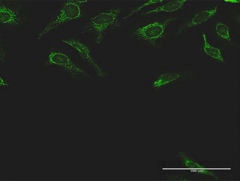 Anti-DLST antibody produced in rabbit purified immunoglobulin, buffered aqueous solution