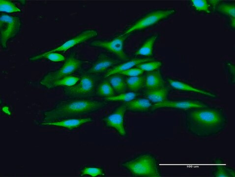 Anti-GUCA1C antibody produced in rabbit purified immunoglobulin, buffered aqueous solution