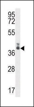 ANTI-TMEM66 (N-TERM) antibody produced in rabbit IgG fraction of antiserum, buffered aqueous solution