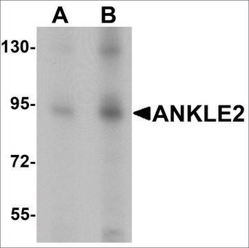 Anti-ANKLE2 antibody produced in chicken affinity isolated antibody