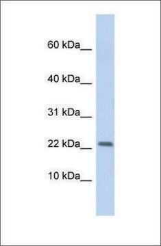 Anti-P2RX7 antibody produced in rabbit affinity isolated antibody