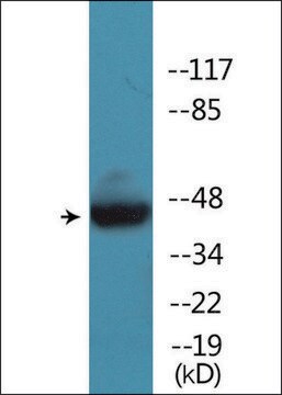 Anti-phospho-CCR5 (pSer349) antibody produced in rabbit affinity isolated antibody