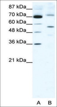 Anti-SIRT3 antibody produced in rabbit IgG fraction of antiserum