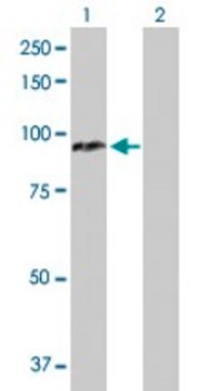 Anti-CPT1A antibody produced in rabbit purified immunoglobulin, buffered aqueous solution