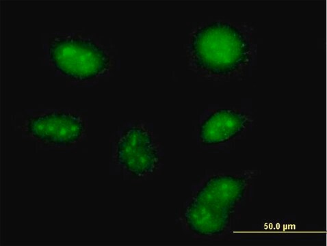 Anti-ZCCHC13 antibody produced in mouse purified immunoglobulin, buffered aqueous solution